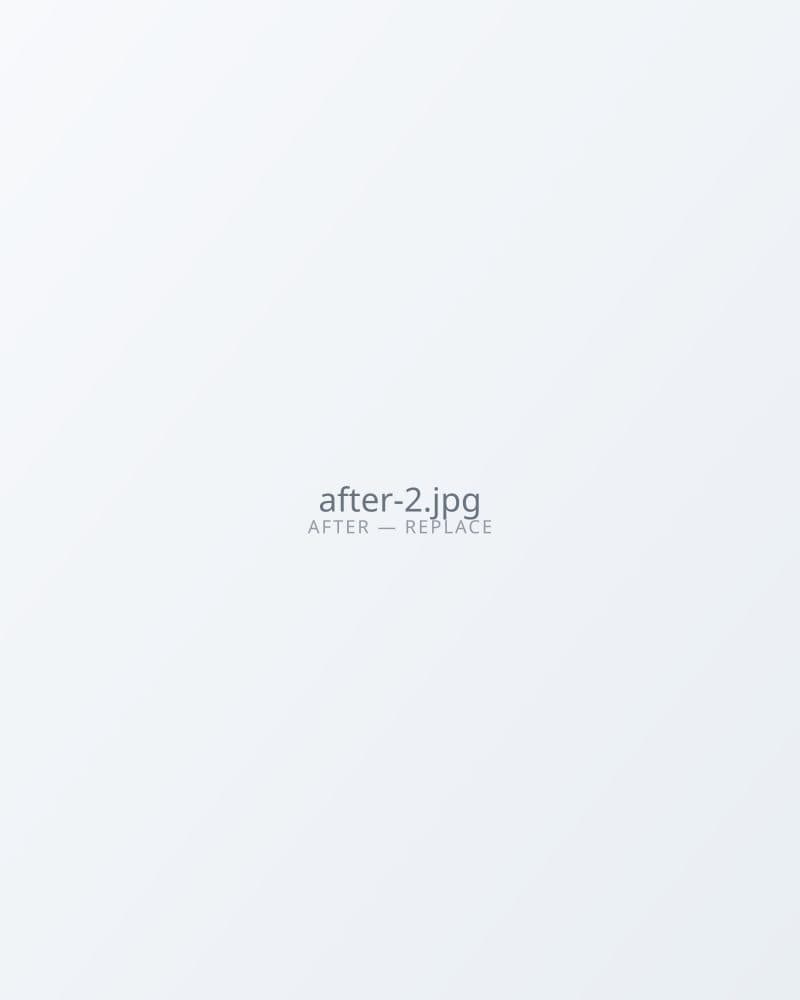 After — Patient Result B