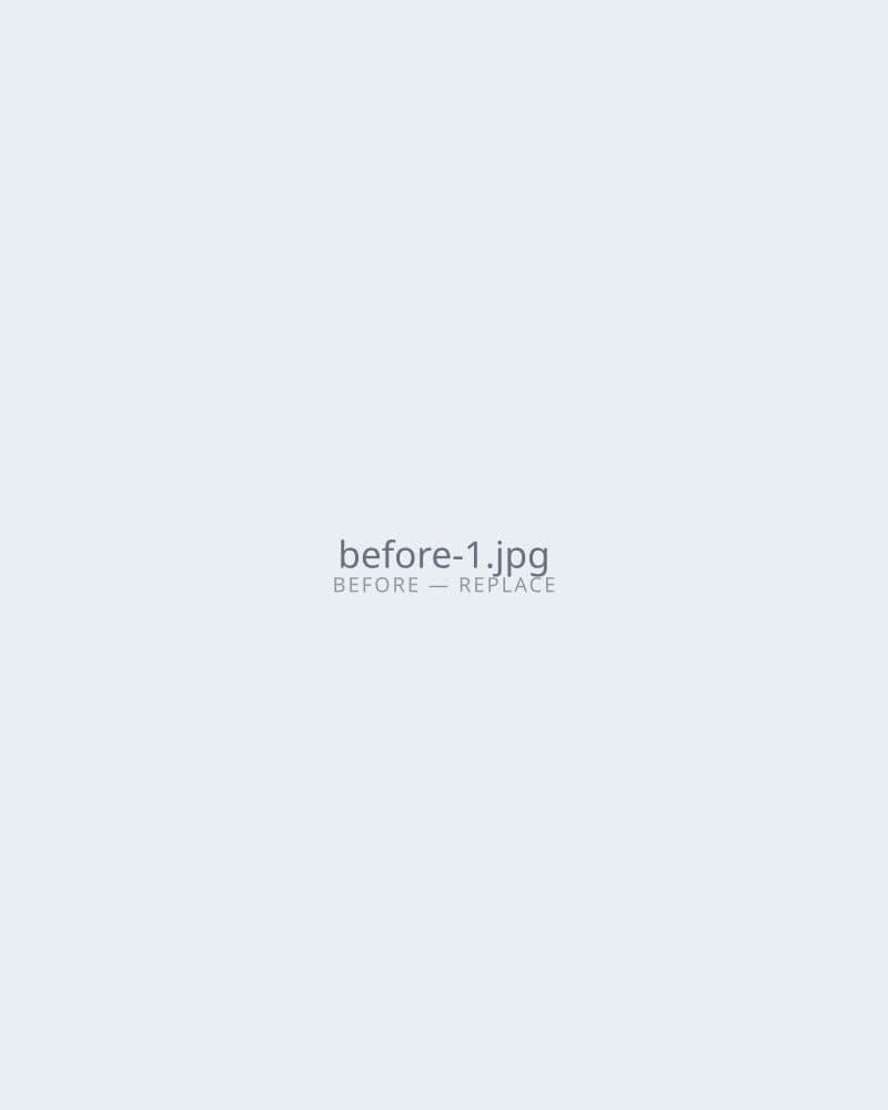 Before — Patient Result A