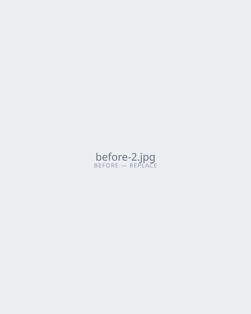 Before — Patient Result B